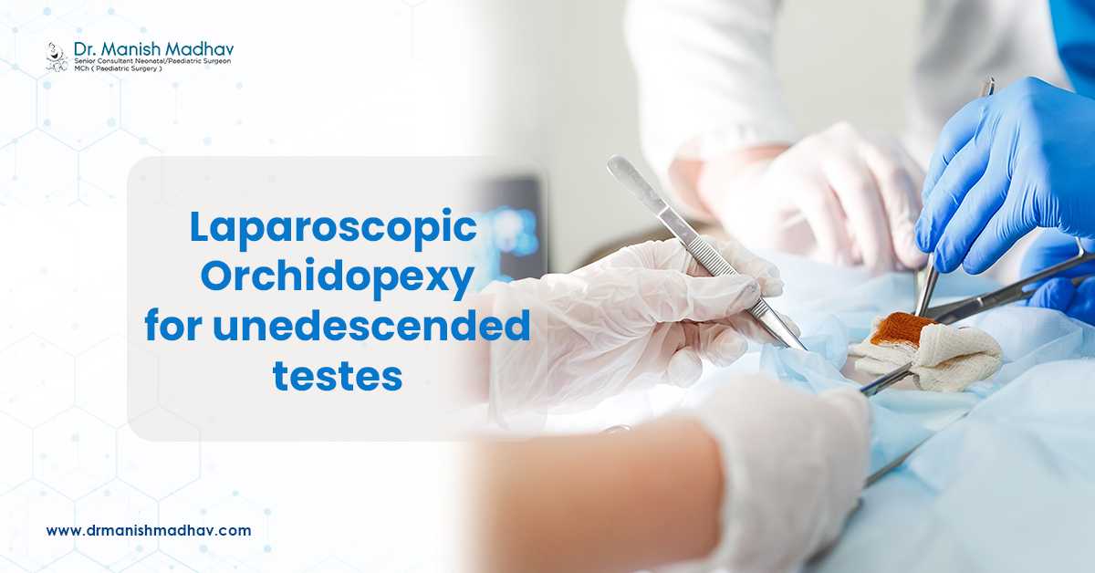 Laparoscopic Orchidopexy For Unedescended Testes