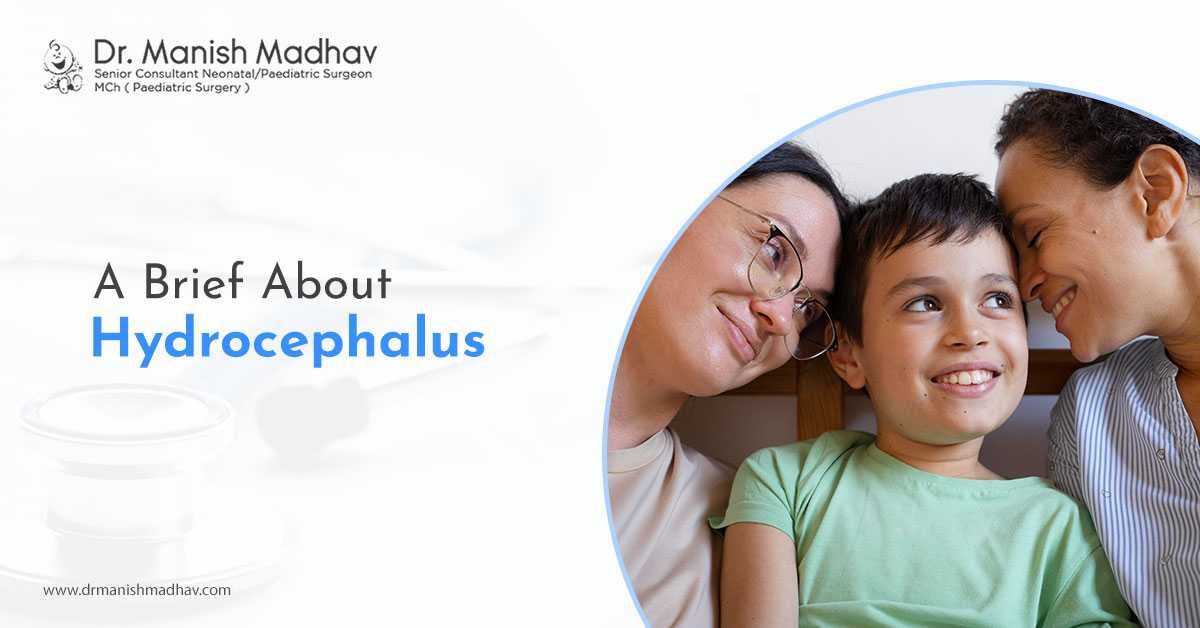 Get The Best Treatment For Hydrocephalus