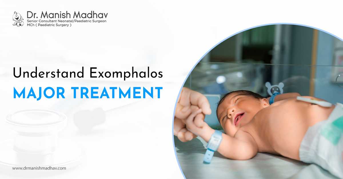 Understand Exomphalos Major Treatment
