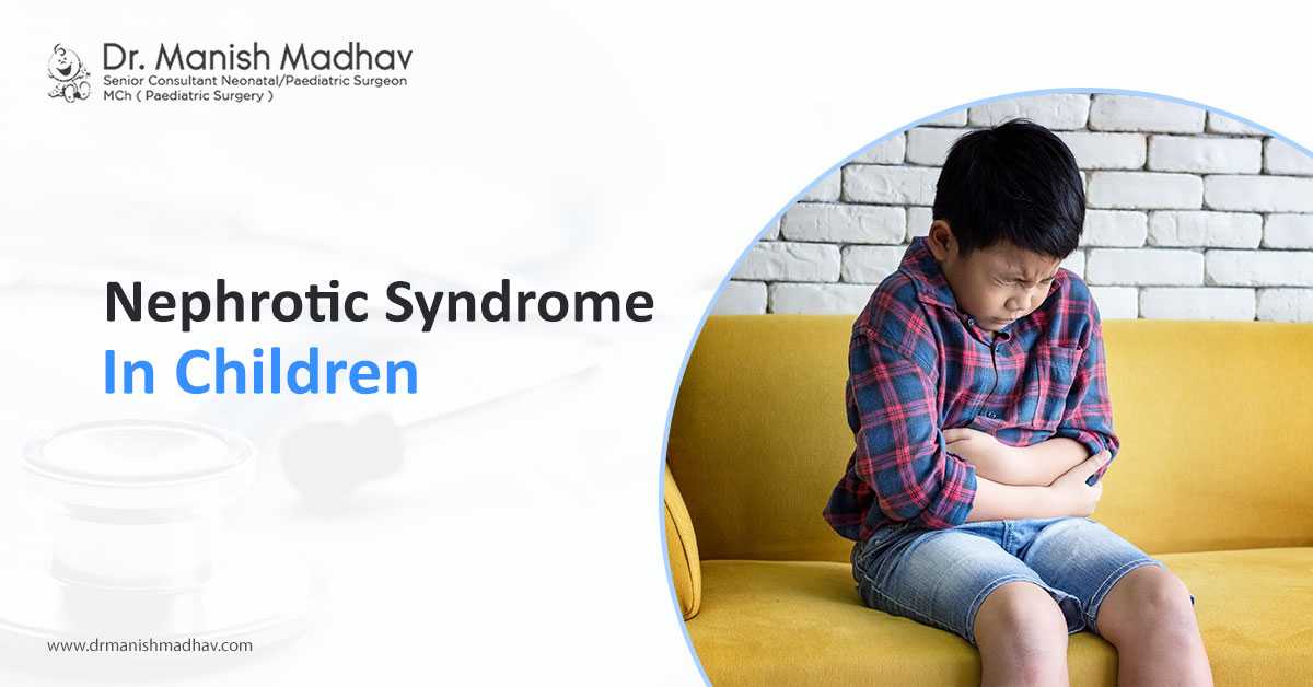 Nephrotic Syndrome in Children
