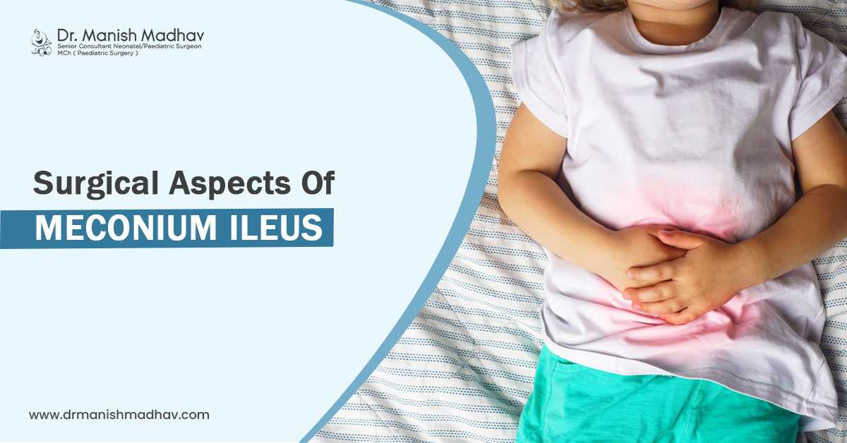 Surgical Aspects of Meconium Ileus