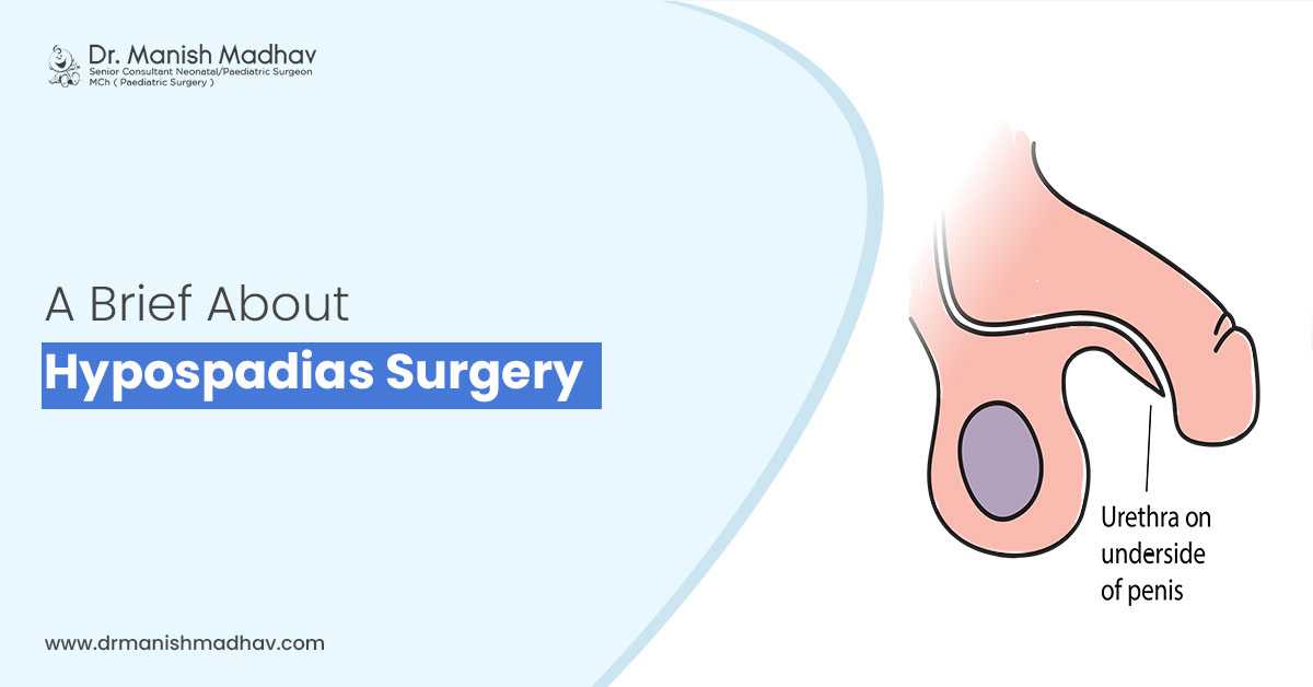 A Brief About Hypospadias Surgery