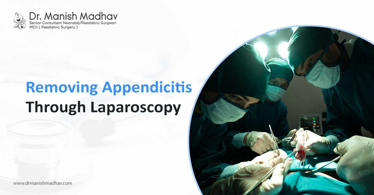 Removing Appendicitis Through Laparoscopy