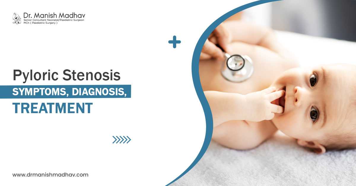 Pyloric Stenosis: Symptoms, Diagnosis, Treatment