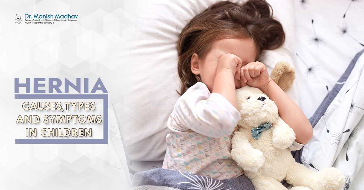 Hernia Causes, Types And Symptoms in Children