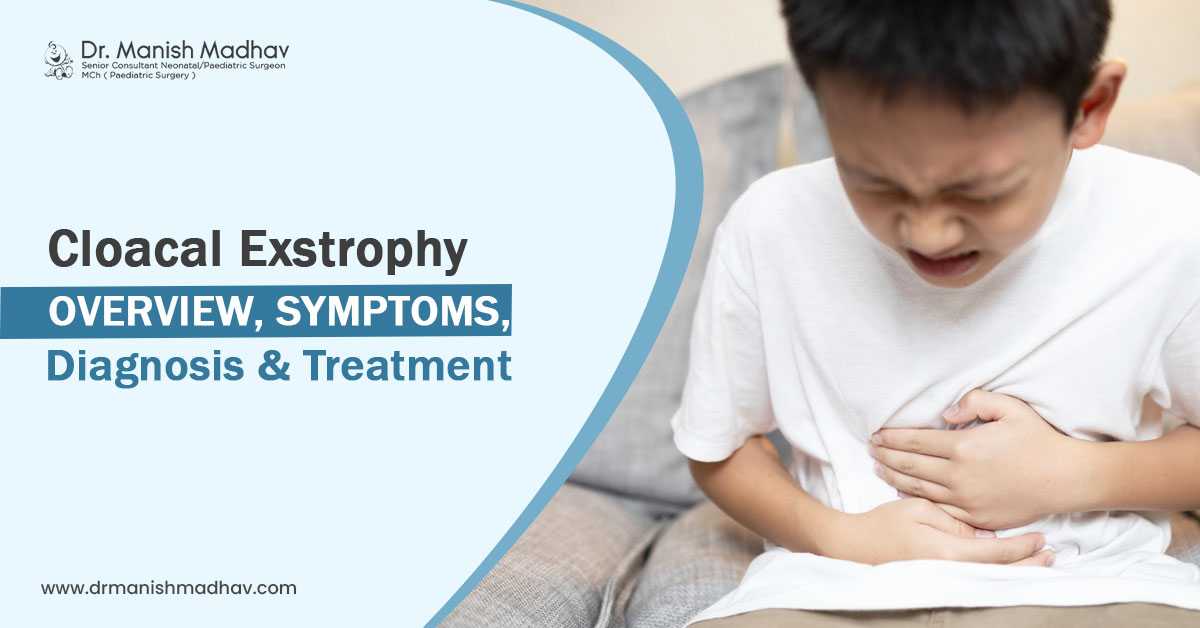 Cloacal Exstrophy: Overview, Symptoms, Diagnosis & Treatment