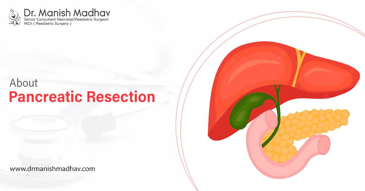 Solve Pancreatic Problem With Hepatobiliary Surgery