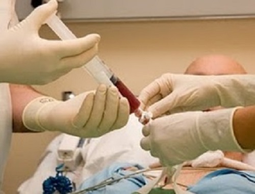 stem-cell-transplantation
